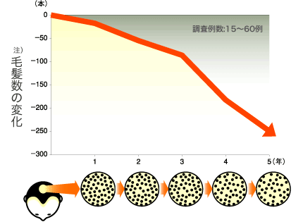 毛髪数の変化