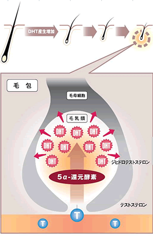 脱毛の原因