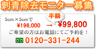 刺青除去モニター募集