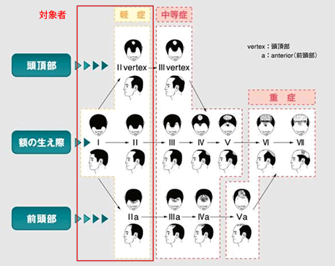 育毛