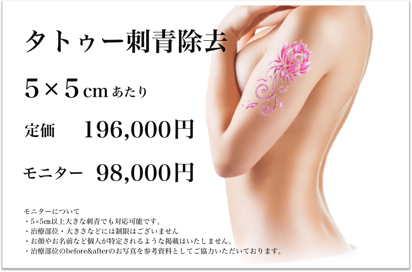 タトゥー・刺青除去手術の料金