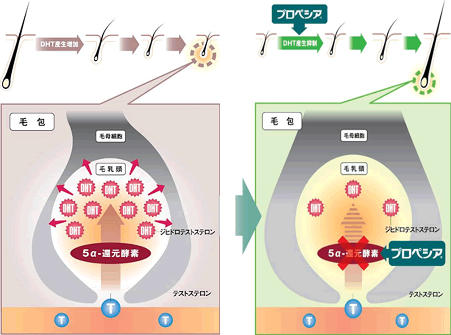 プロペシアの効果