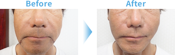 40代男性 Before After