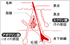 わきが（ワキガ・腋臭症）とは