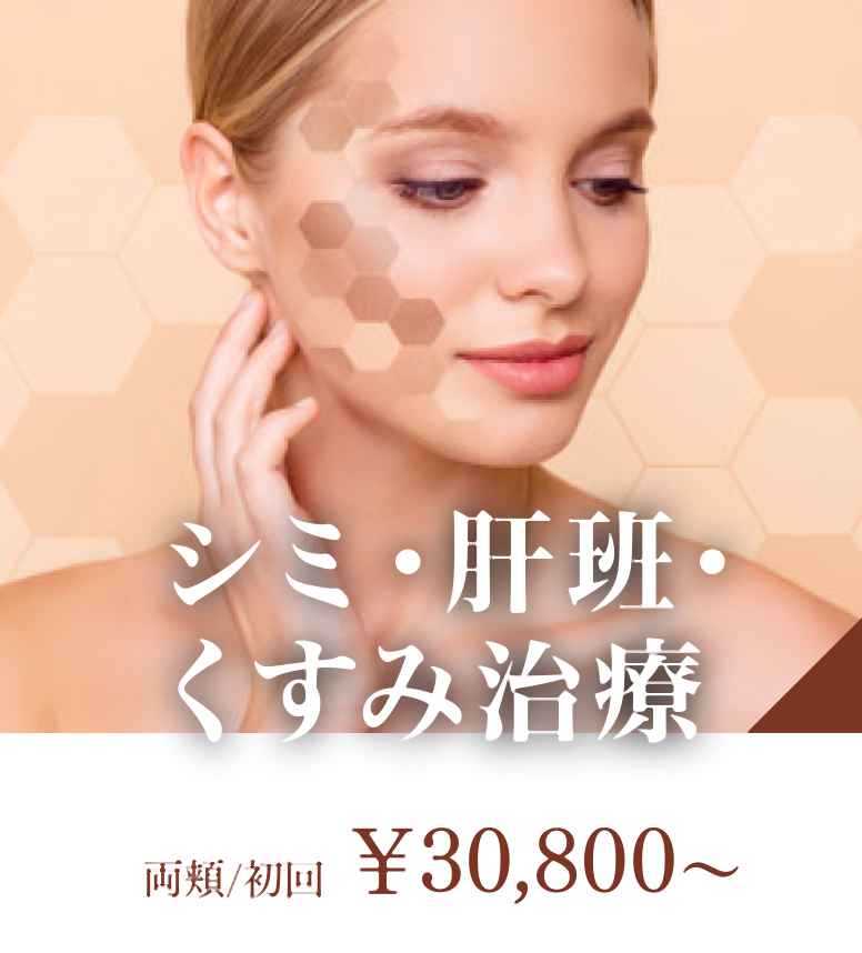 シミ・肝斑・くすみ治療