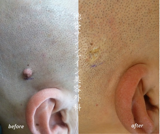 098ebed0c7b41edf3318d50d6d85b962