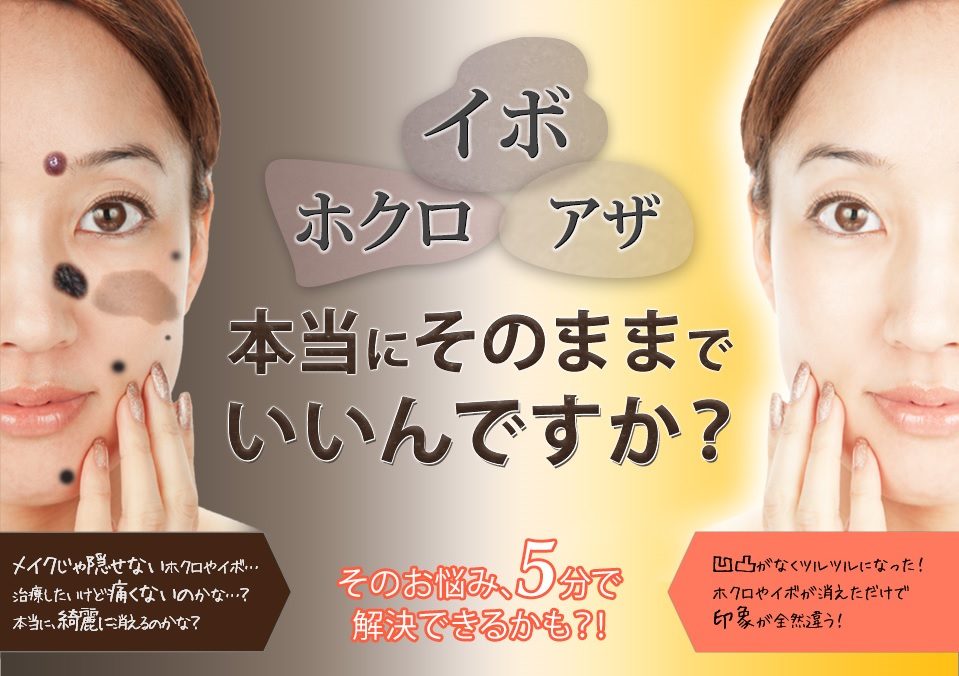 ホクロ除去a8