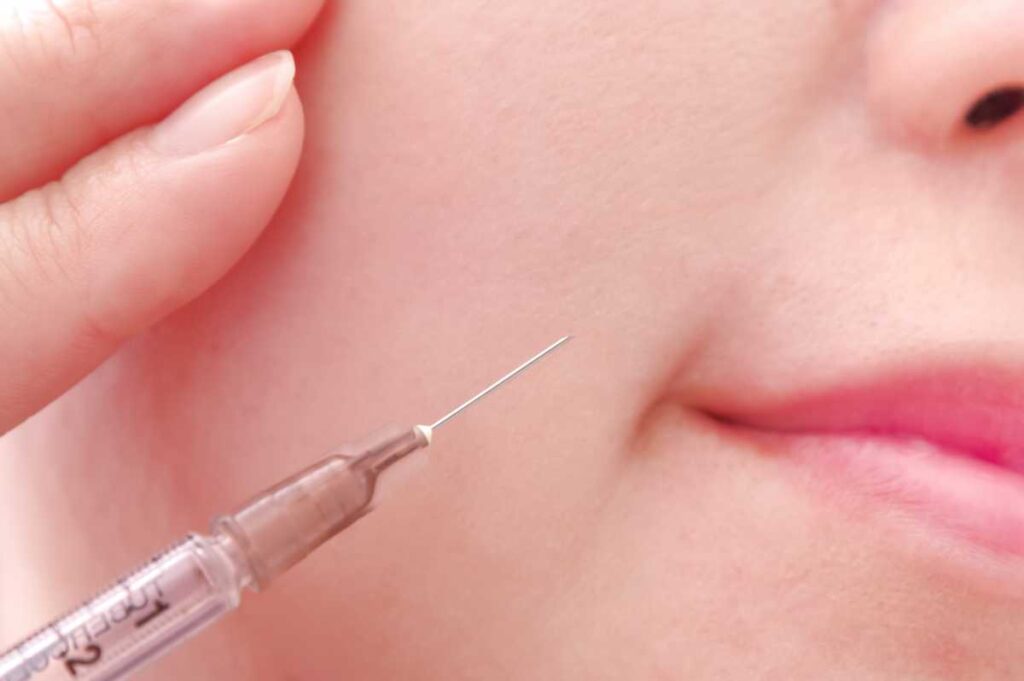 ボトックス注射の効果を感じやすい部位のイメージ