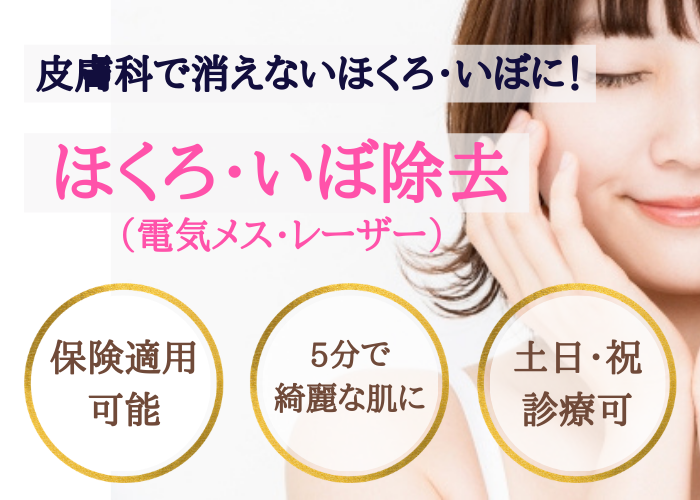 ほくろ除去治療 保険適用可 東京 池袋サンシャイン美容外科