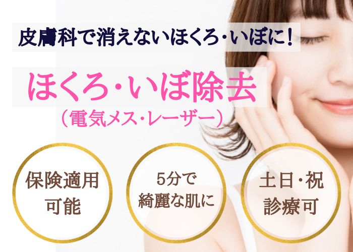 短時間で完了のほくろ除去治療について