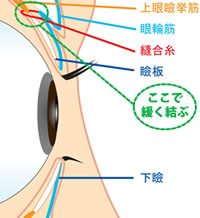 施術方法、特徴紹介