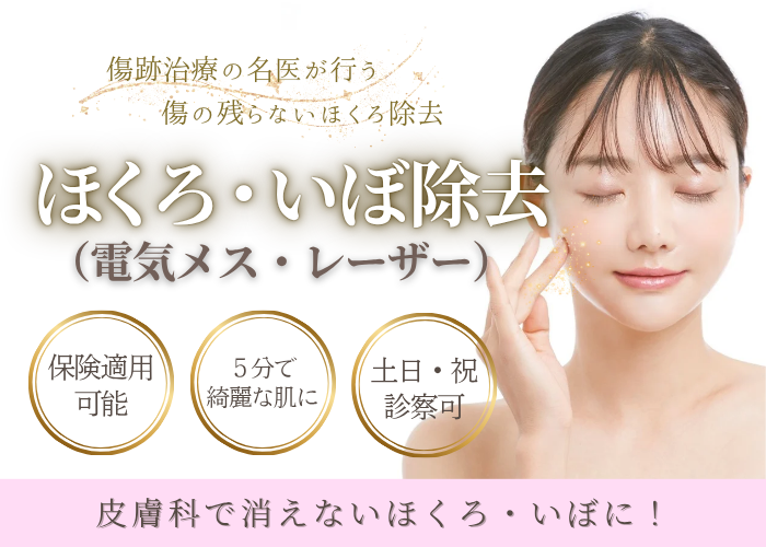 ほくろ除去・イボ治療 1 ほくろ・いぼ治療/保険診療の池袋サンシャイン美容外科