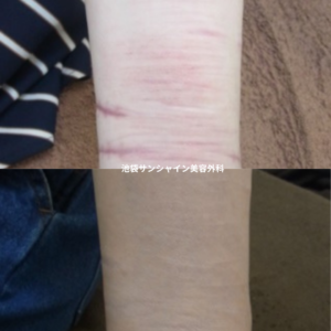 217 、19 池袋サンシャイン美容外科