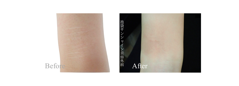 TASK₋53アイキャッチ画像 1 1