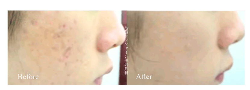 TASK₋53アイキャッチ画像 3