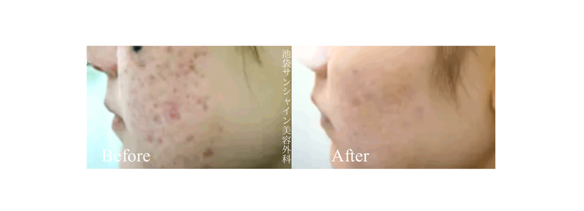 TASK₋53アイキャッチ画像 4