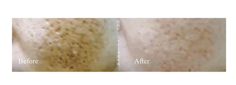 TASK₋53アイキャッチ画像