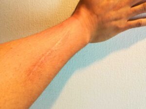 傷跡のある画像