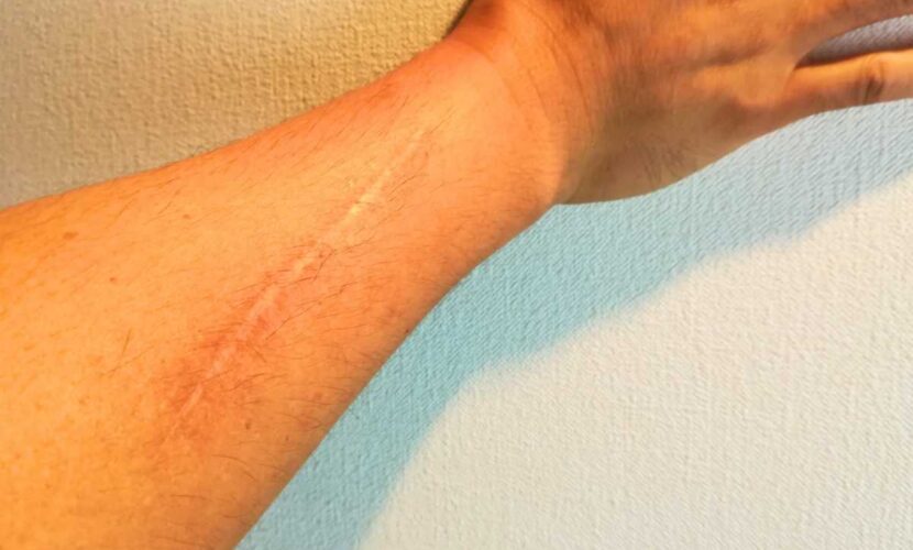 傷跡のある画像