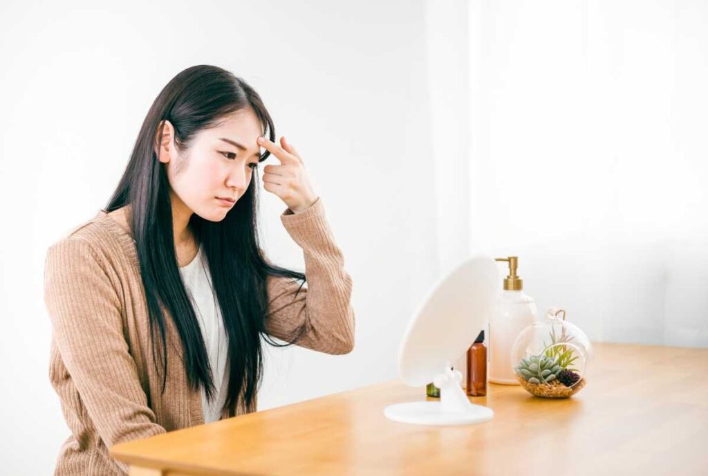 おでこの凹んだ傷跡に悩んでいる女性のイメージ