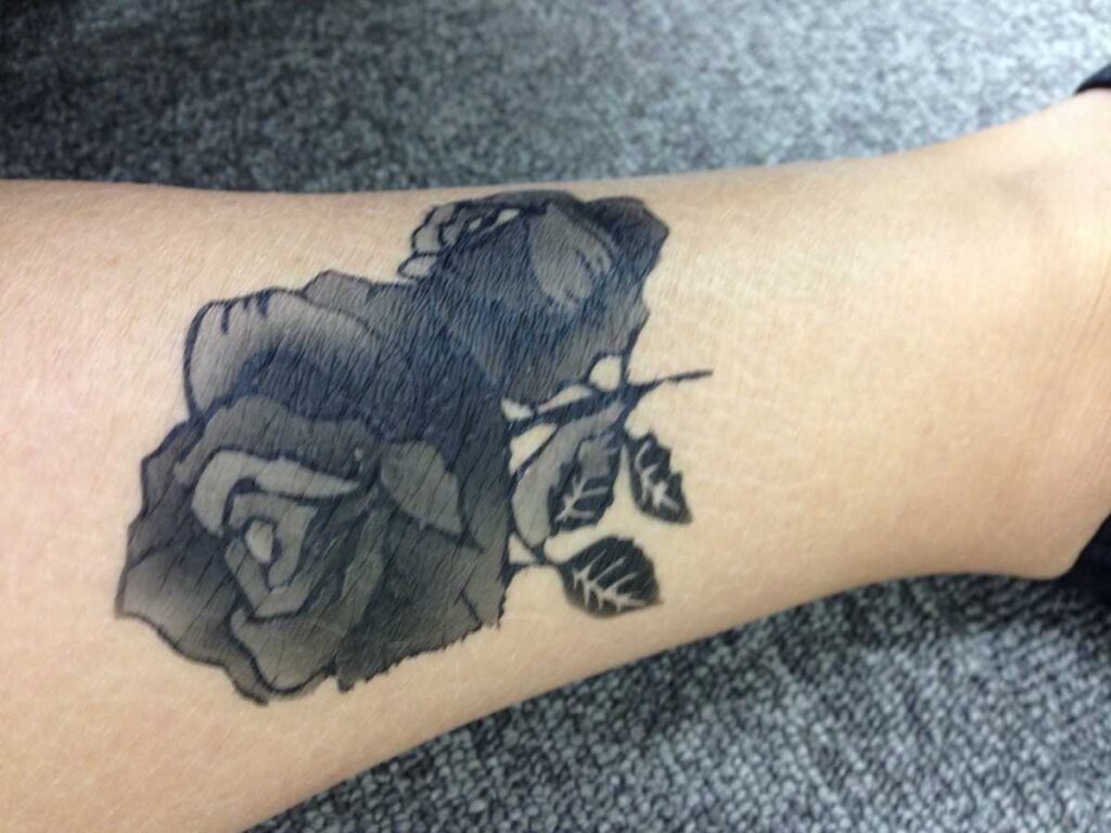 タトゥーの消す方法を模索している人の腕のイメージ