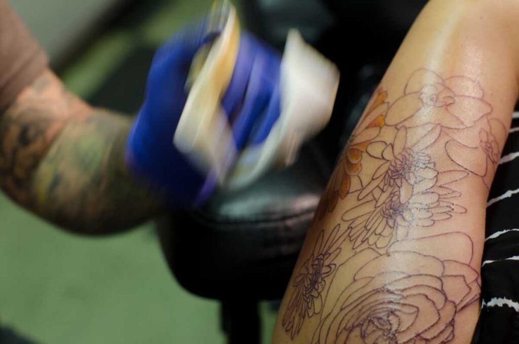 刺青を消したいなら切除やレーザーが有効