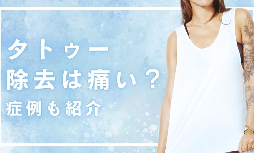 タトゥー除去は痛い？症例も紹介