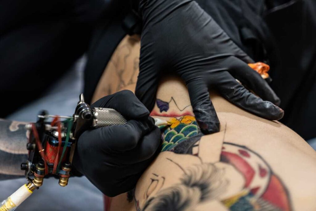 タトゥー除去の事例