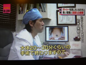 タトゥー除去でテレビ取材を受ける院長