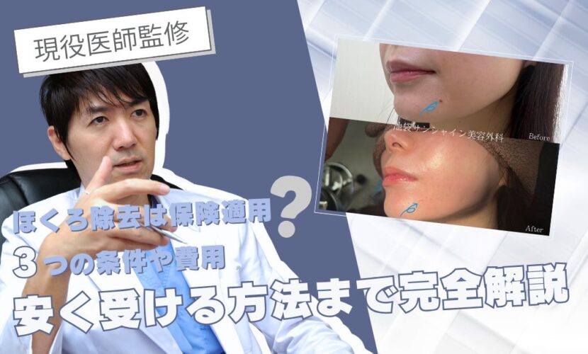 【現役医師監修】ほくろ除去は保険適用？3つの条件や費用・安く受ける方法まで完全解説