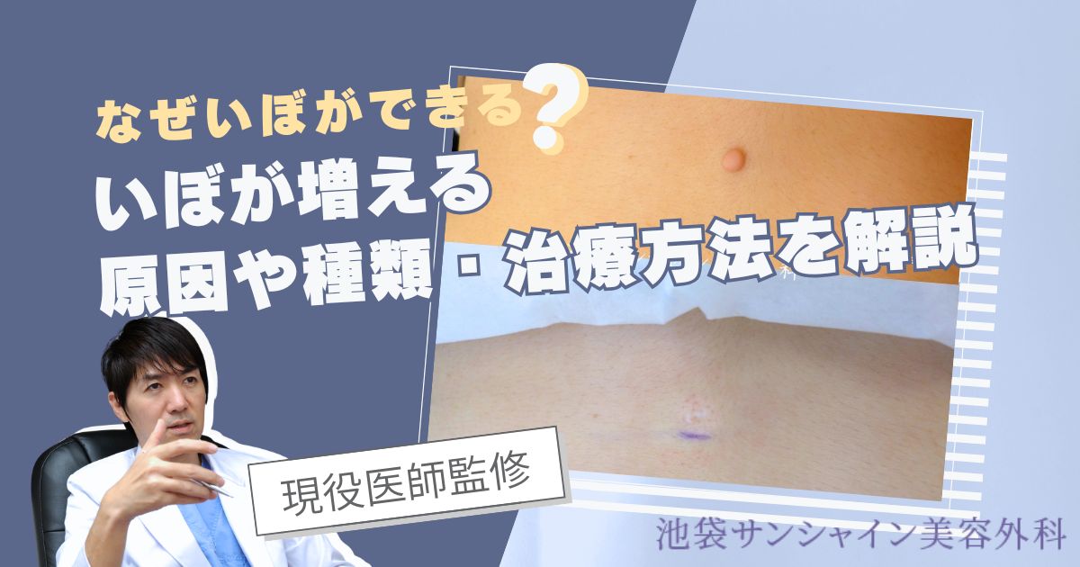 なぜいぼができる？いぼが増える原因や種類・治療方法を解説【現役医師