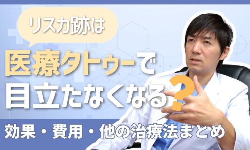リスカ跡は医療タトゥーで目立たなくなる？