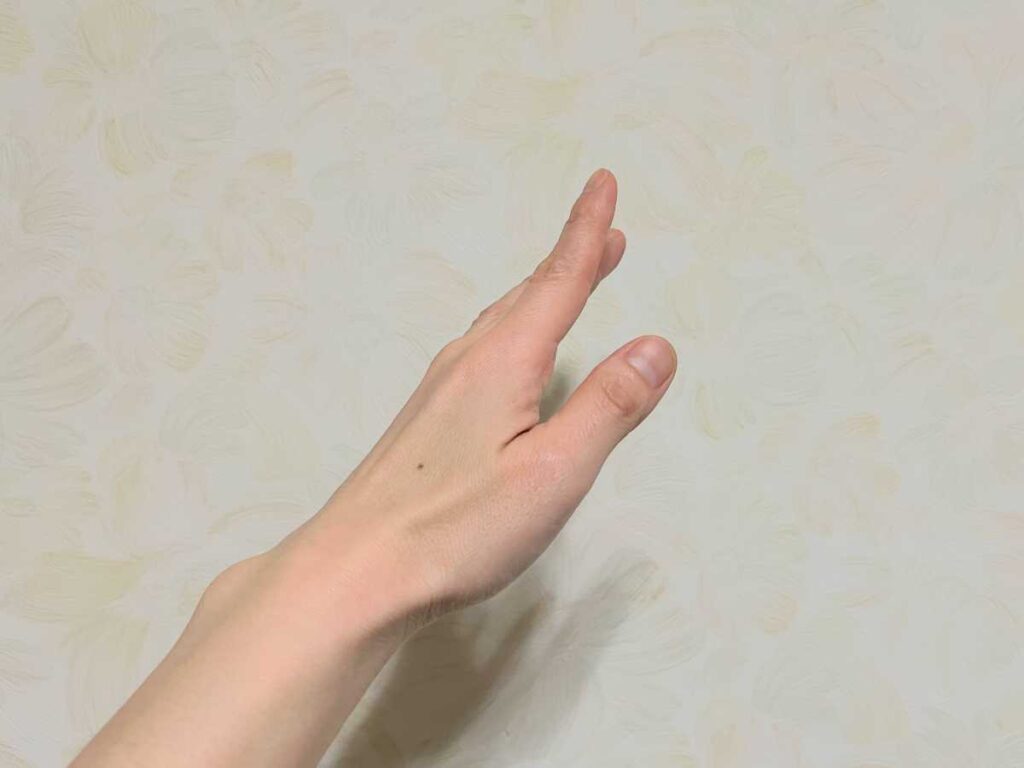 【医師が解説】ホクロが増えるのはなぜ?原因とほくろを消す治療法やケアを紹介 4 部位別のホクロが増える原因
