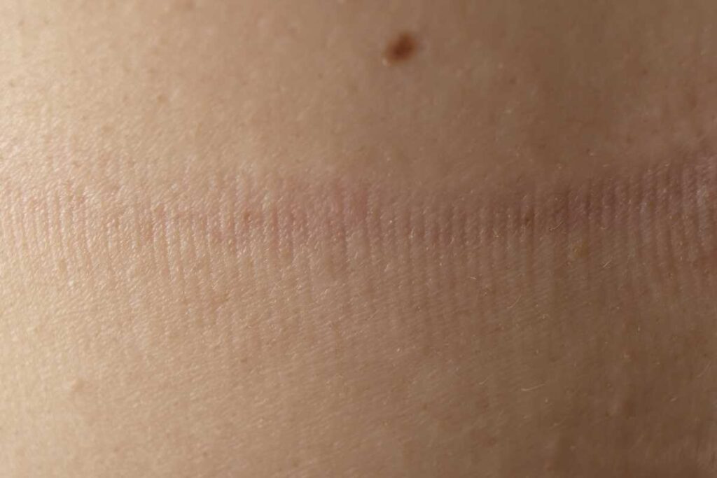 【医師が解説】ホクロが増えるのはなぜ?原因とほくろを消す治療法やケアを紹介 5 ホクロが増えるのを防ぐ予防法