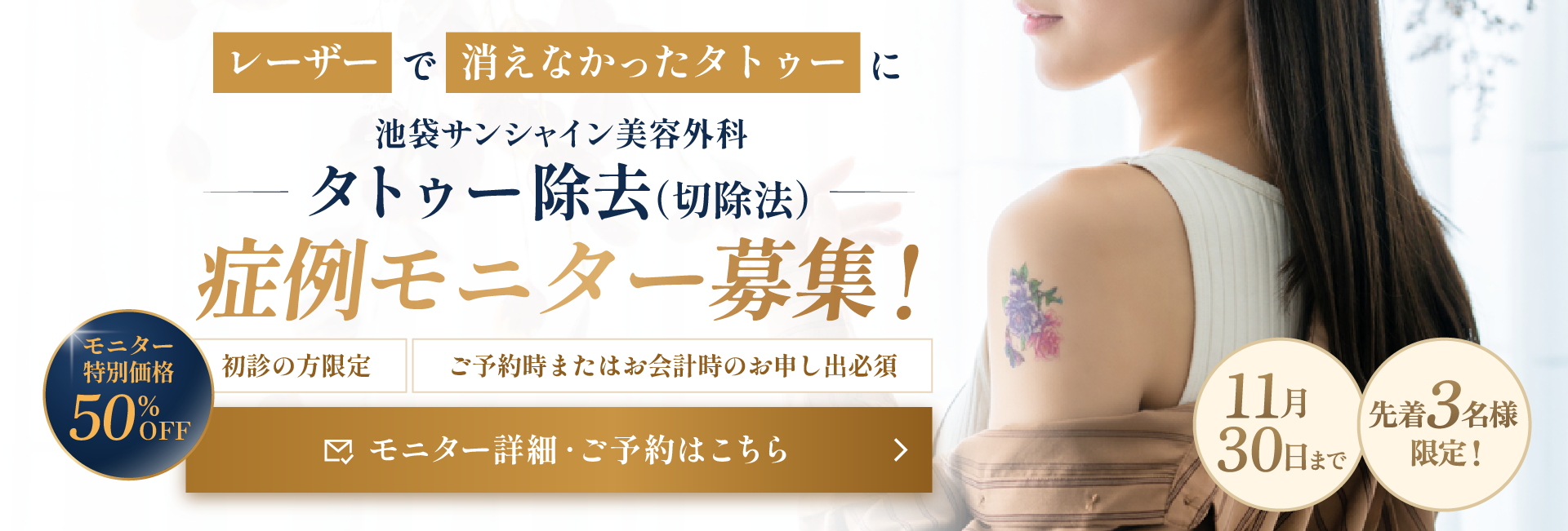 タトゥー除去(切除法) 症例モニター募集 先着3名様限定 50%OFF 11月30日まで