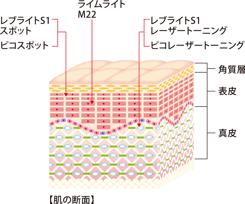 肌の断面図