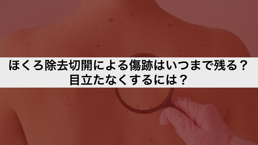 ほくろ除去切開による傷跡はいつまで残る?目立たなくするには?