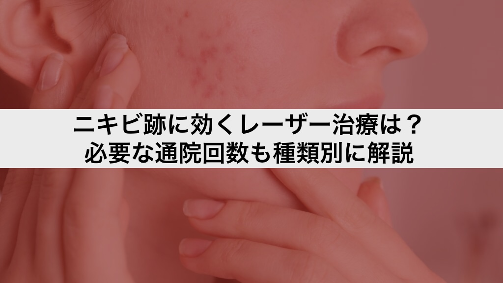 ニキビ跡に効くレーザー治療は?必要な通院回数も種類別に解説
