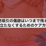 脂肪吸引の傷跡はいつまで残る？目立たなくするためのケア方法
