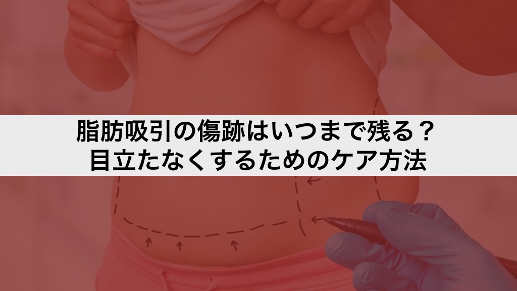 脂肪吸引の傷跡はいつまで残る?目立たなくするためのケア方法